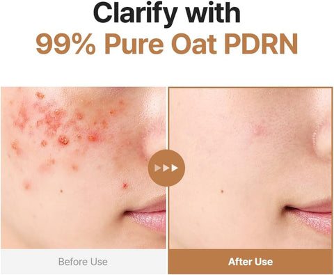 Purito Seoul Oat Pdrn Gentle Refining Toner 200Ml