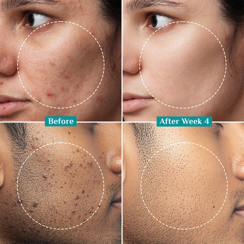 PILGRIM Brightening Serum 30 ml