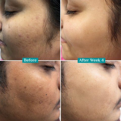 Pilgrim 10% Vitamin C Face Serum For Triple Glow+++- 30 ml