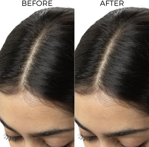 Brillaire Lactylate Scalp Serum 30Ml