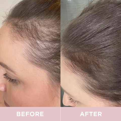 Revive Collagen Enhance Plus 22G sach 14S