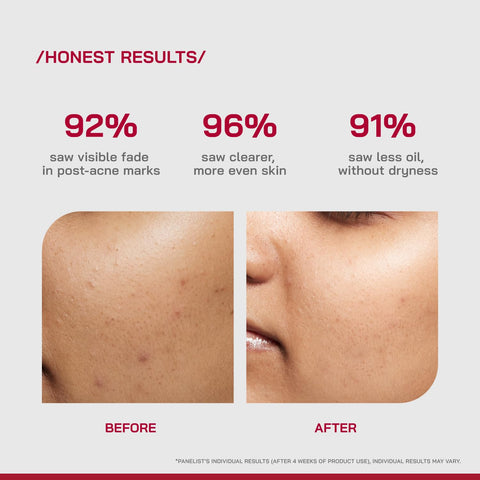 PHD 10% Niacinamide Spot Correcting Serum 30ml
