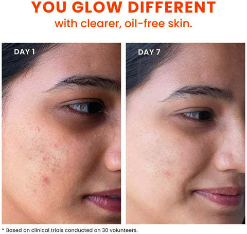 Foxtale True Clarity Oil and Acne Control Face Wash - 100ml