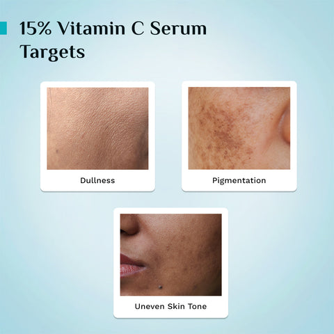 "Pilgrim 15% Vitamin C Face Serum For Advanced Brightness- 20 ml