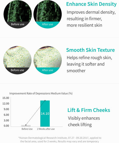 Rejuran Healer Turnover Ampoule 30Ml