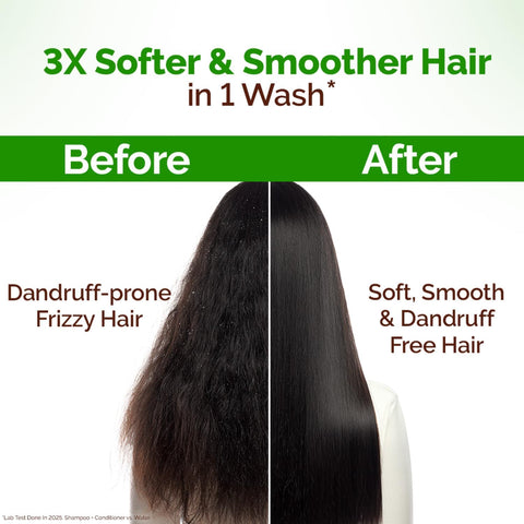 Mamaearth Lemon Anti-Dandruff Conditioner 250 ml