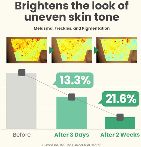 مجموعة الإضاءة المصغرة من AXIS-Y
