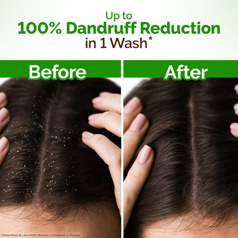 Mamaearth Lemon Anti-Dandruff Shampoo 400 ml