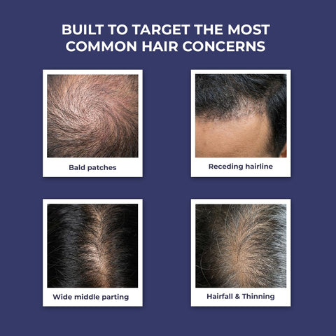 Conscious Chemist Full Strength Anti-Hairfall Post Wash Rosmeary Spray 200 ml