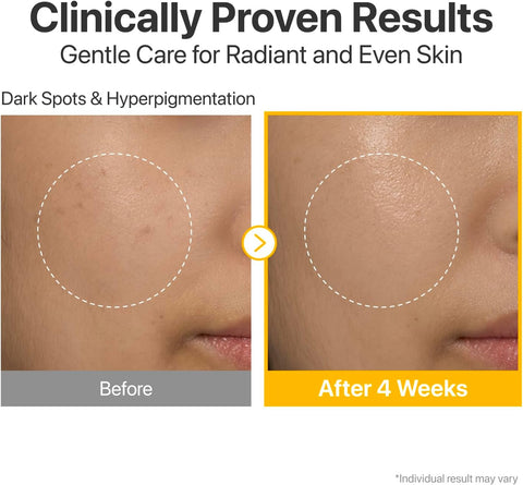 Numbuzin Vitamin Concentrated Serum