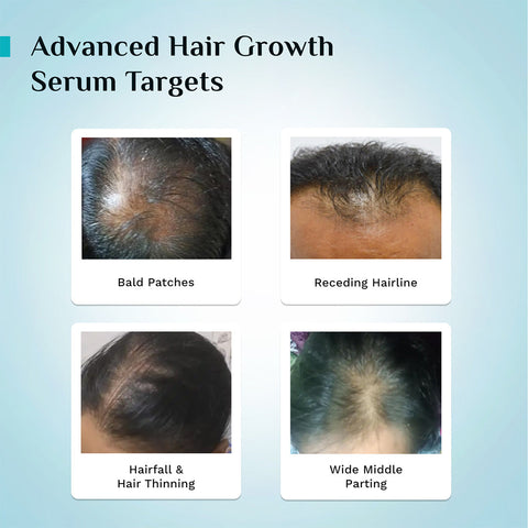 Pilgrim 3% Redensyl, 4% Anagain & 5% Capilia Stem Cell Complex Advanced Hair Growth Serum- 50 ml