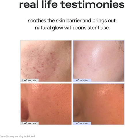 Glow Vegan Face Moisturiser - Aloe Vera Barrier Support, 50ml